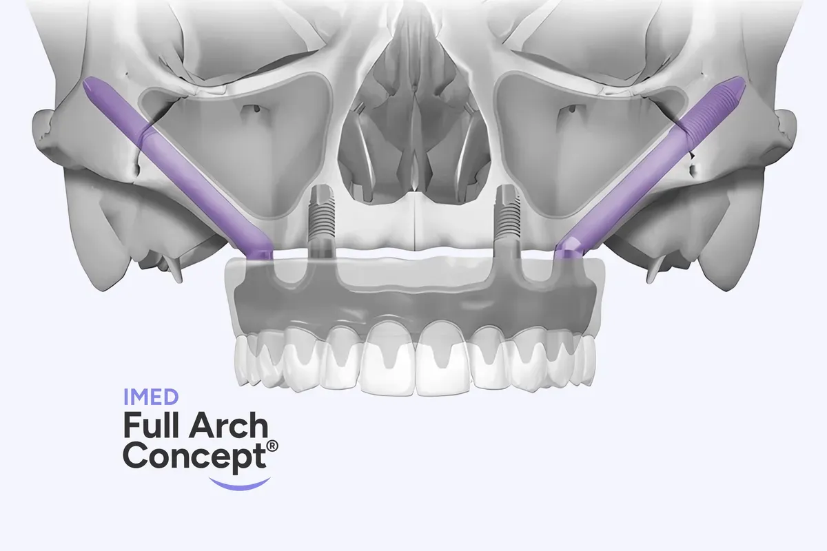 Imed Full Arch Concept Logo