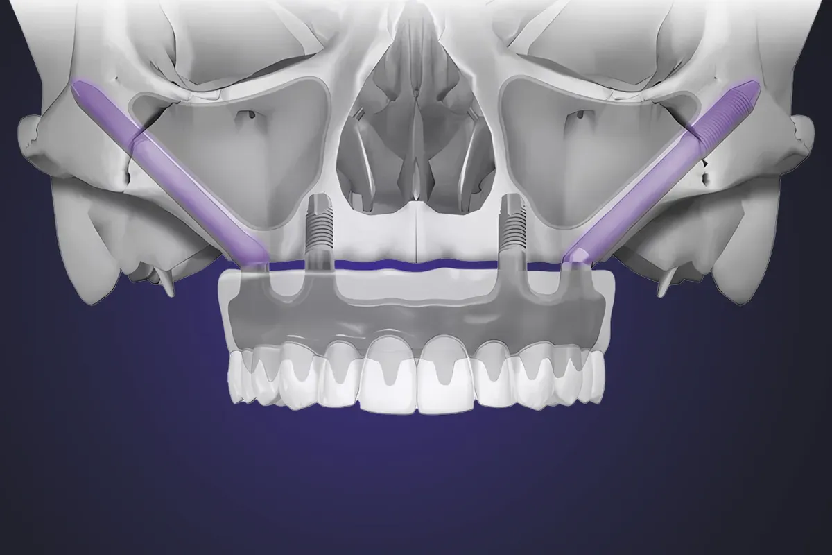 imed-full-arch-concept