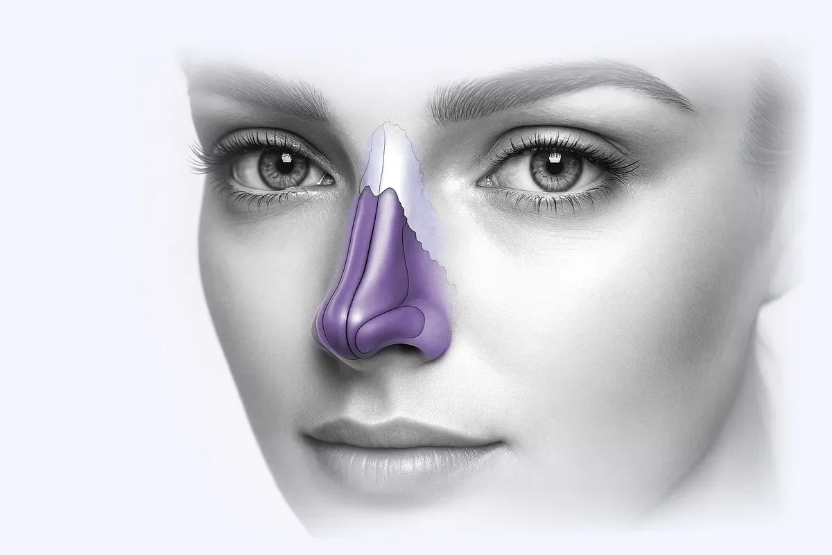 Imed Rinoplastika Anatomija Nosa